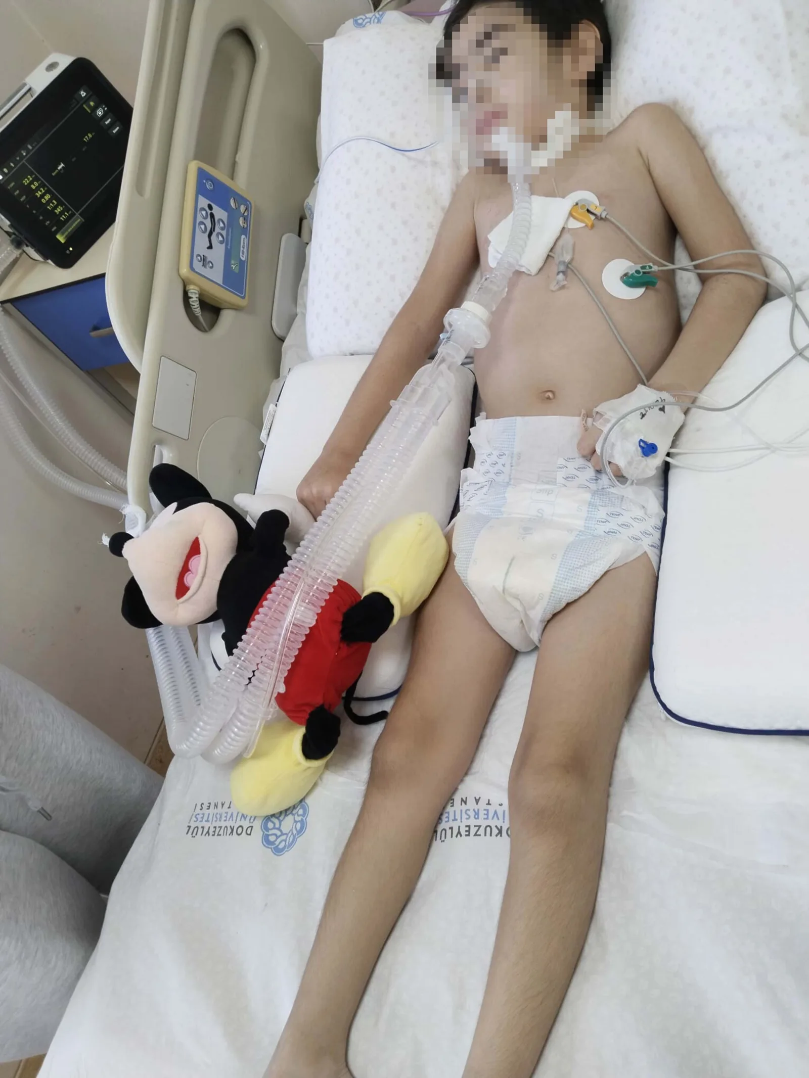 Çocuğun yetişkin havuzunda boğulma tehlikesi geçirdiği olaya ilişkin bilirkişi raporu: Tedbirsizlik