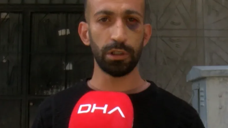 Gaziosmanpaşa’da taciz iddiasıyla darbedilen kiracı: Fatura ödemeleri yüzünden tartıştık