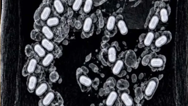 Havalimanında şüpheli yolcunun midesinden 322 gram metamfetamin çıktı