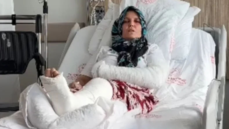 Kavgada 3 çocuk annesinin kolu ve bacağı kırıldı