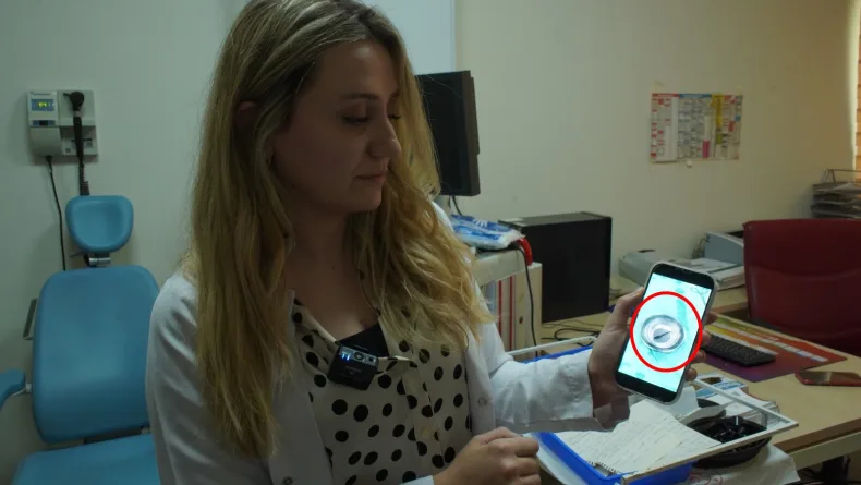 Siirt'te 10 yaşındaki çocuğun boğazından canlı sülük çıktı