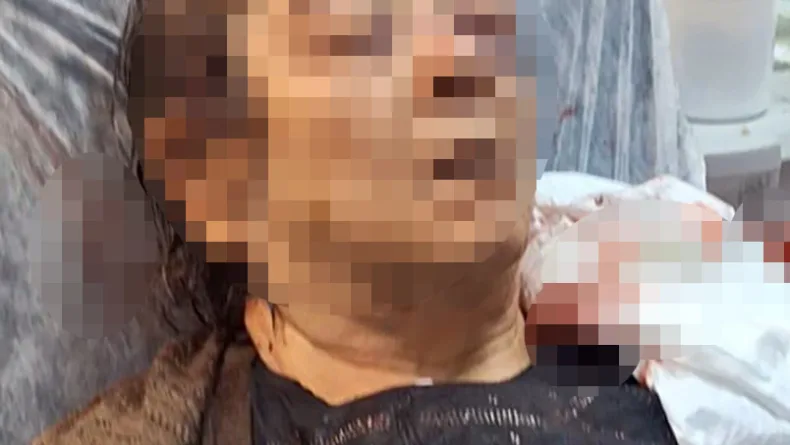 Tavandan başına sıva parçaları düşen kadının oğlu: Burnunda kırık, sol gözünde görme kaybı var