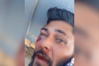 TACIZ SUPHELISINI DOVUP JANDARMAYA TESL 1104239 327775