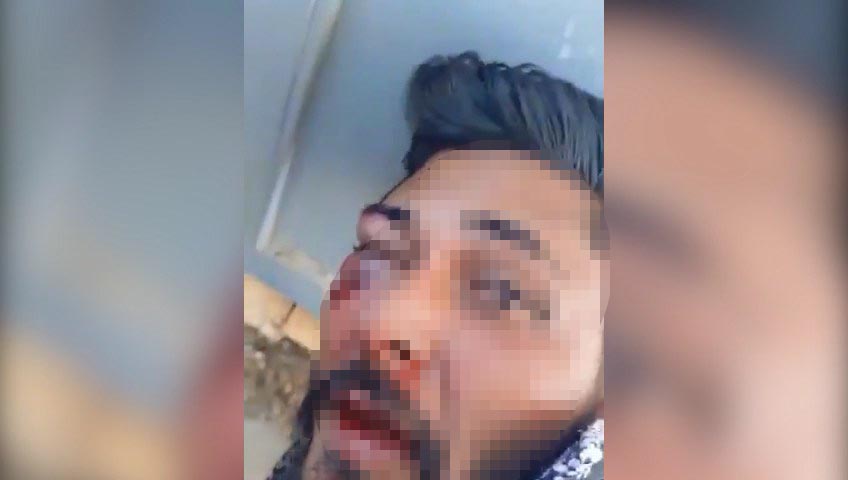 TACIZ SUPHELISINI DOVUP JANDARMAYA TESL 1104239 327775