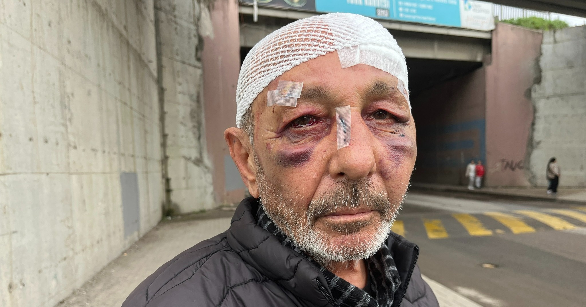 Ali Aladağ (67), araçla yanına yaklaşan kişiler tarafından darbedildi