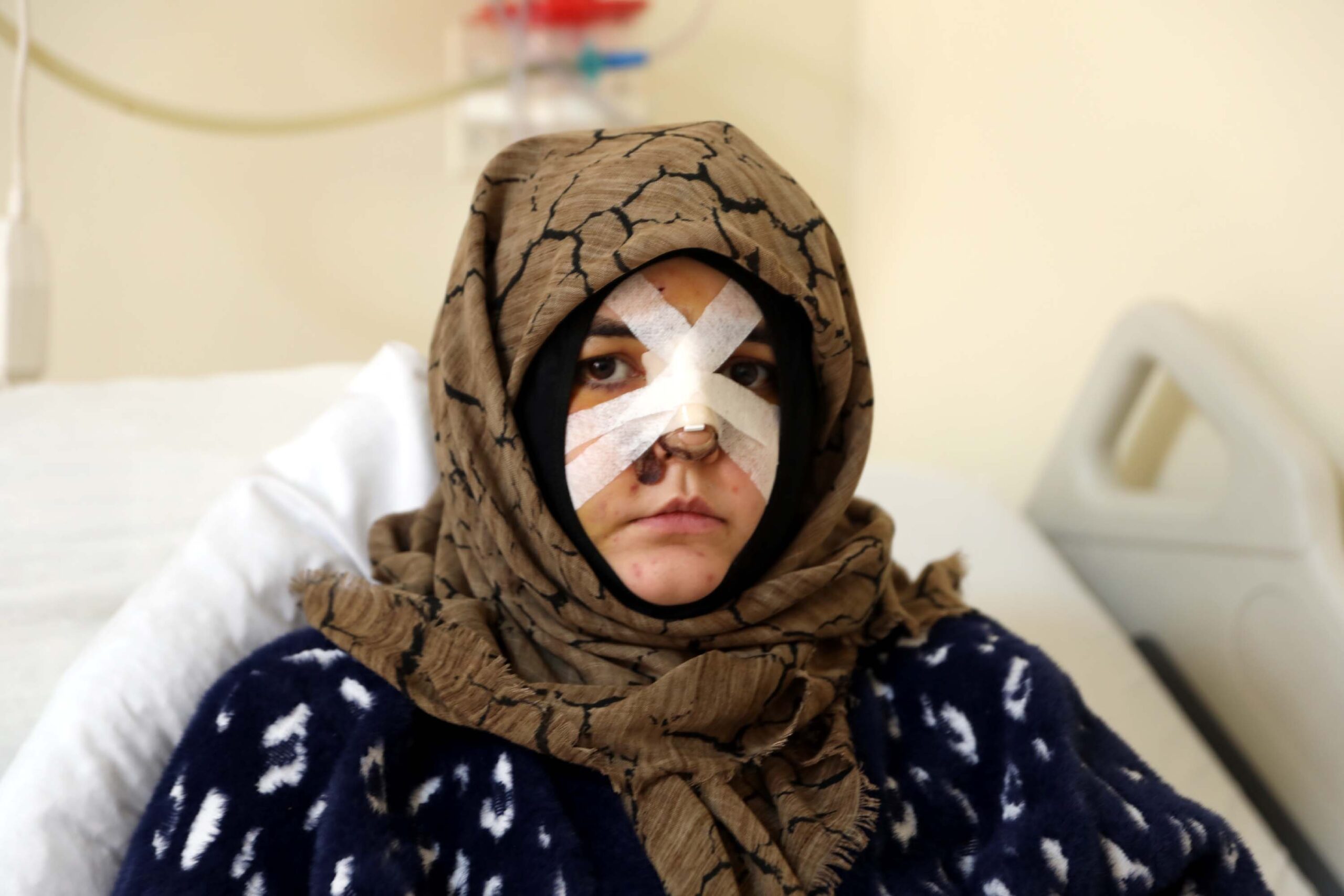 Eşinin kaldırım taşı ile dövdüğü Nazlı: Çıkarsa yar.