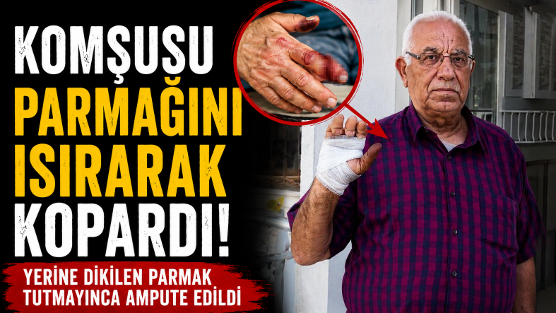 PARMAK