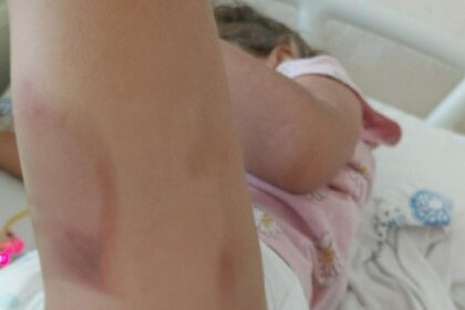 3 YASINDAKI YAREN AMELIYATTAN YANIK IZLE 942756 279994 scaled e1759410303931