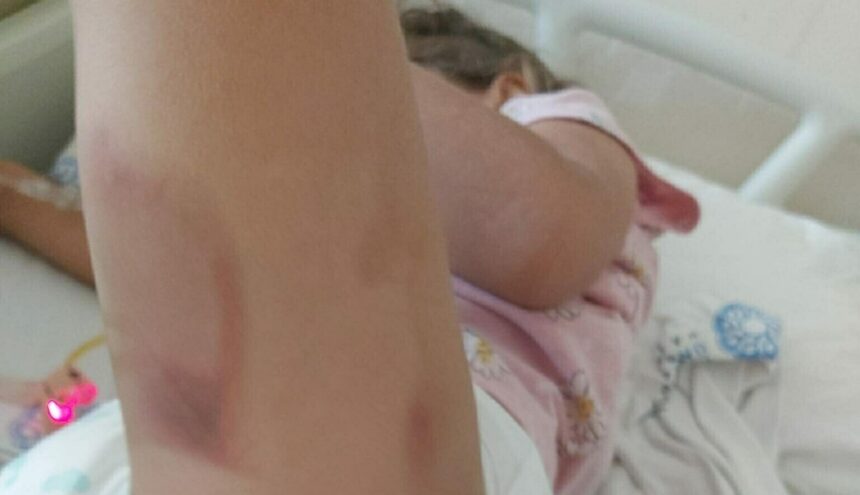 3 YASINDAKI YAREN AMELIYATTAN YANIK IZLE 942756 279994 scaled e1759410303931