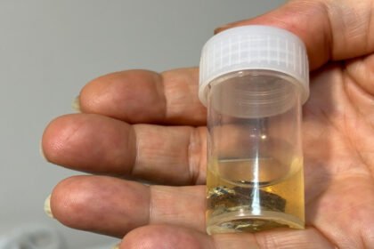 ALUMINYUM KABIYLA YUTTUGU HAP 4 YIL SON 1070167 317566 e1766144137887