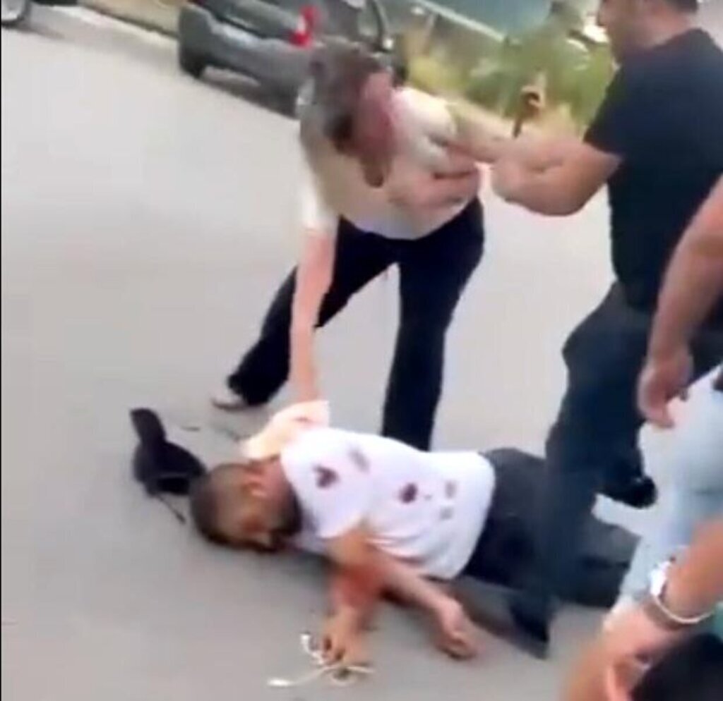 ANKARA HEMSIRENIN YARALIYA MUDAHALESININ 352242 97214 e1728046593845