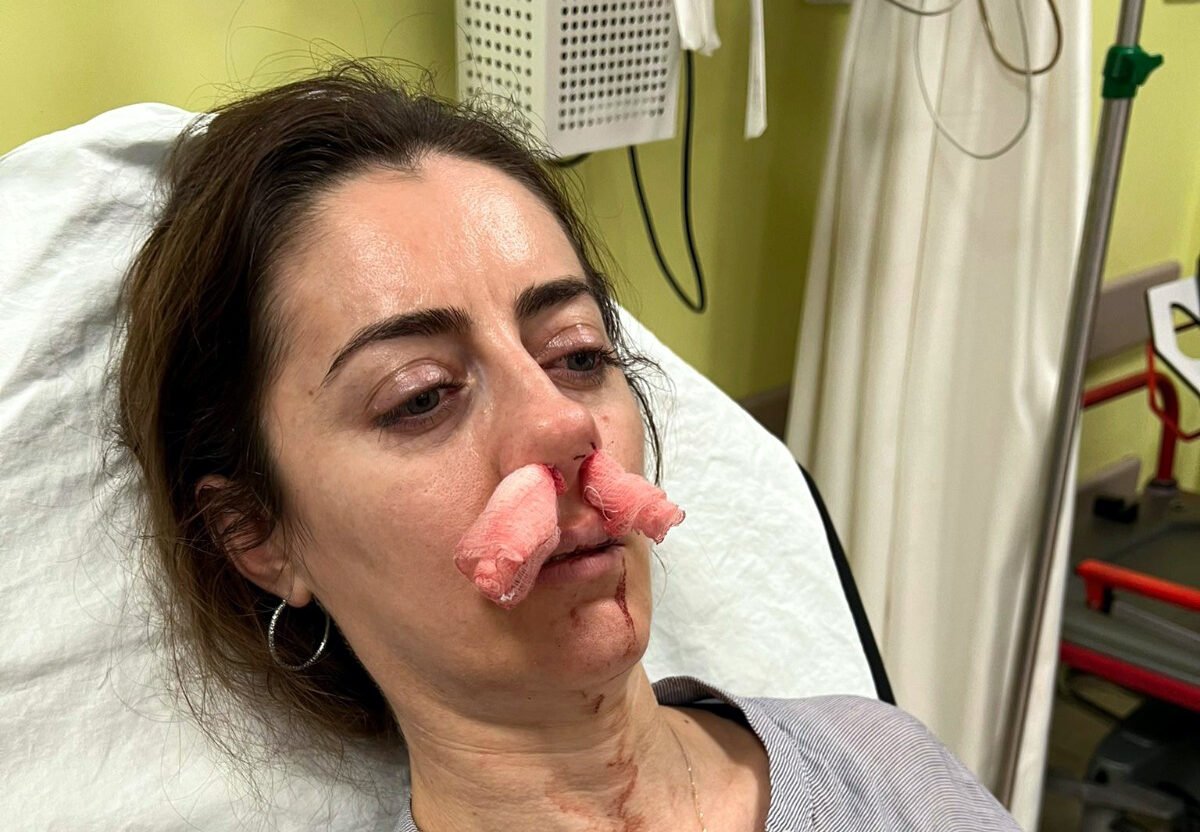 Eşinin sevgilisi sandığı kadını darbettiği 'otomobil kap.