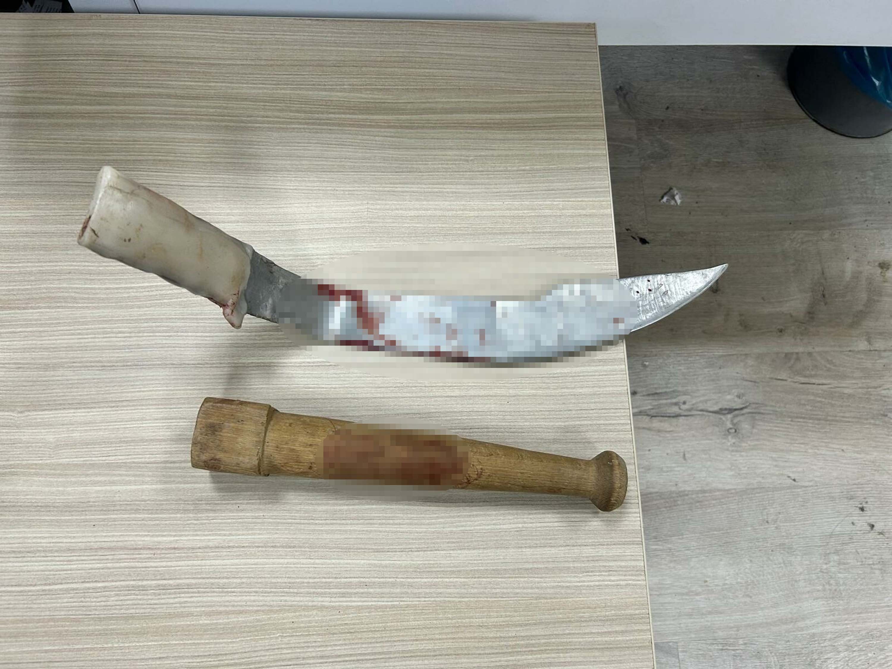 İzmir’de kayınpeder ile damadın pala ve sopalı kavgası: 2