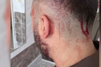 SANLIURFA OGRETMENE OKULDA DEMIR SOPALI 970277 288155 e1760907704834