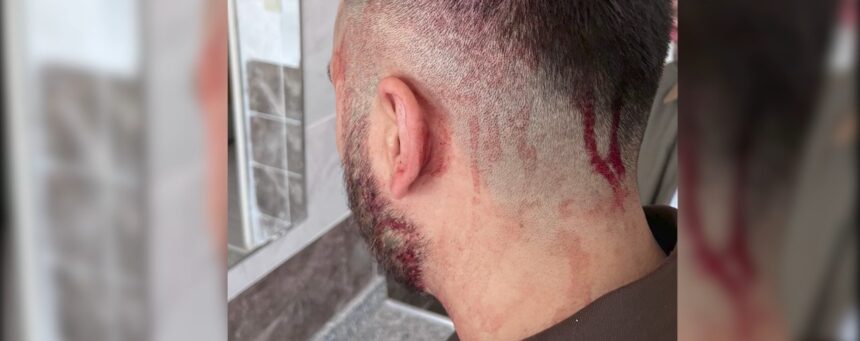 SANLIURFA OGRETMENE OKULDA DEMIR SOPALI 970277 288155 e1760907704834