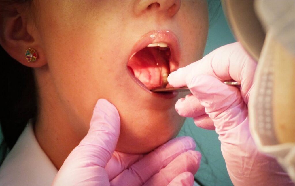 bademcik ve genizeti