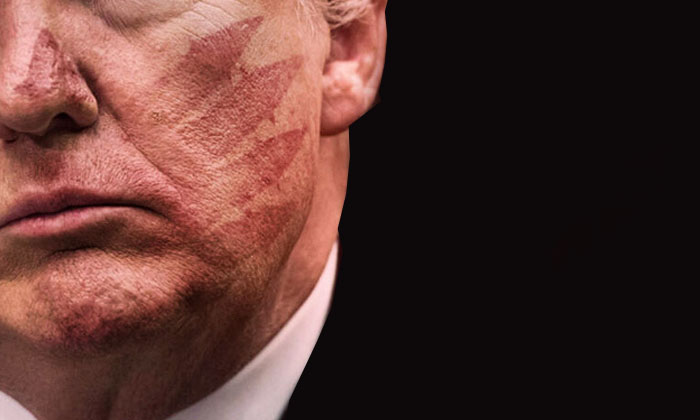 Trump’ın yüzünde tokat izleri