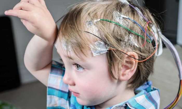Çocuk EEG çekimi Büyük Anadolu Hastaneleri’nde başladı