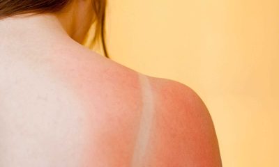 Güneşin insan vücuduna etkileri