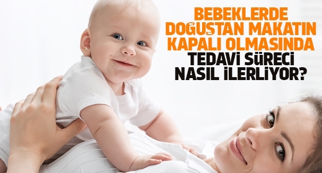 Bebeklerde doğuştan makatın kapalı olmasında tedavi süreci nasıl ilerliyor!