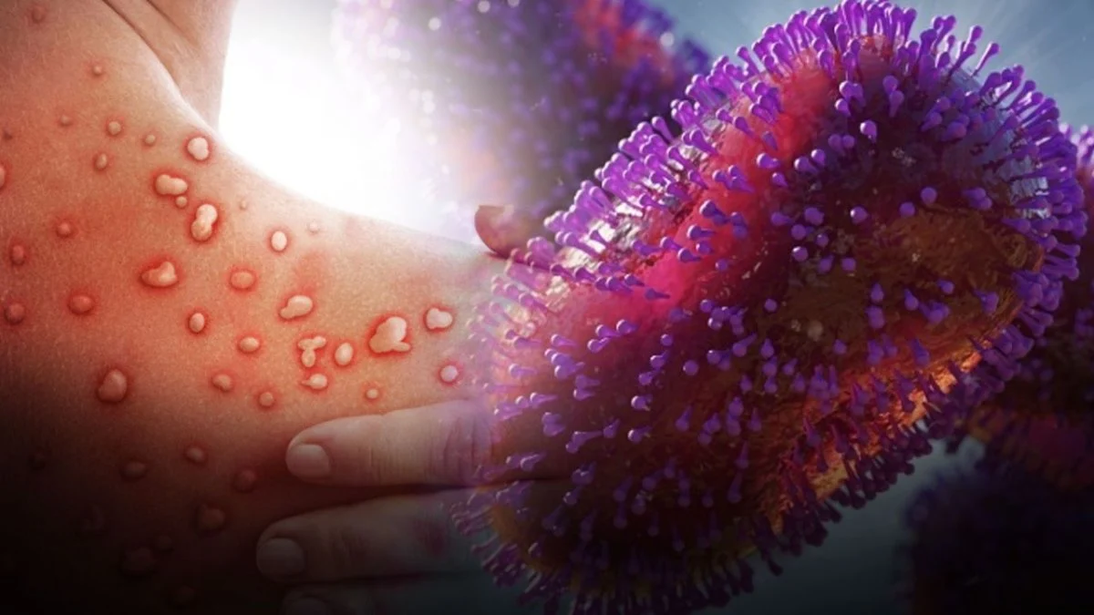 maymun cicegi 1.webp