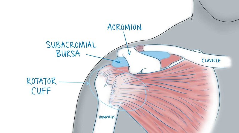 Rotator Cuff (Manşet) Yırtıkları’nın belirtileri, tanı ve tedavi süreci