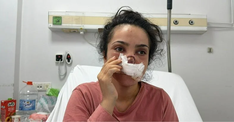 Tartışma Dehşete Dönüştü! Eşinin Burnunu Isırarak Kopardı