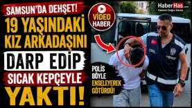 Samsun'da 19 Yaşındaki Kız Arkadaşını Darp Edip Sıcak Kepçeyle Yaktı!