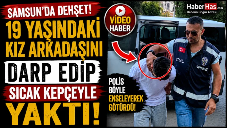 Samsun'da 19 Yaşındaki Kız Arkadaşını Darp Edip Sıcak Kepçeyle Yaktı!