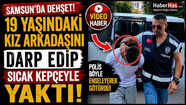 Samsun’da 19 Yaşındaki Kız Arkadaşını Darp Edip Sıcak Kepçeyle Yaktı!